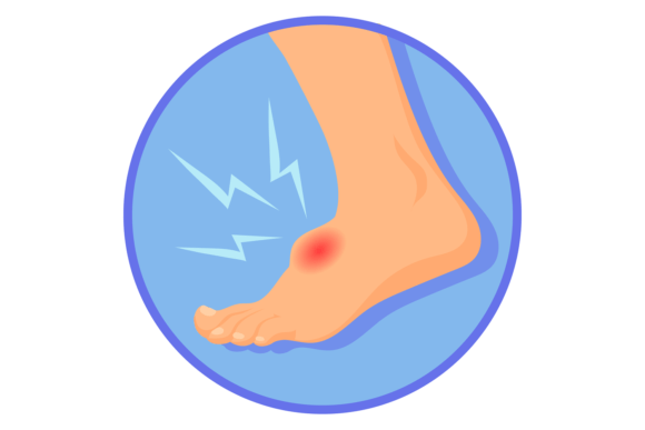 Foot Hurt Illustration: Graphics for Branding